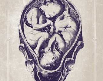 Póster de clínica de fertilidad con arte vintage personalizable de gemelos en el útero. Embarazo, útero y mujer.