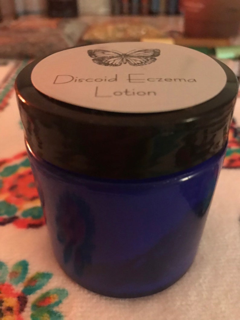 Discoid Eczema Treatment