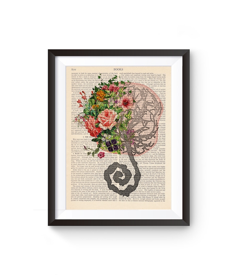 Placenta Print, Umbilical Cord Illustration, Birth, Vintage Anatomy, Medical Print, Mother Gift Idea image 2