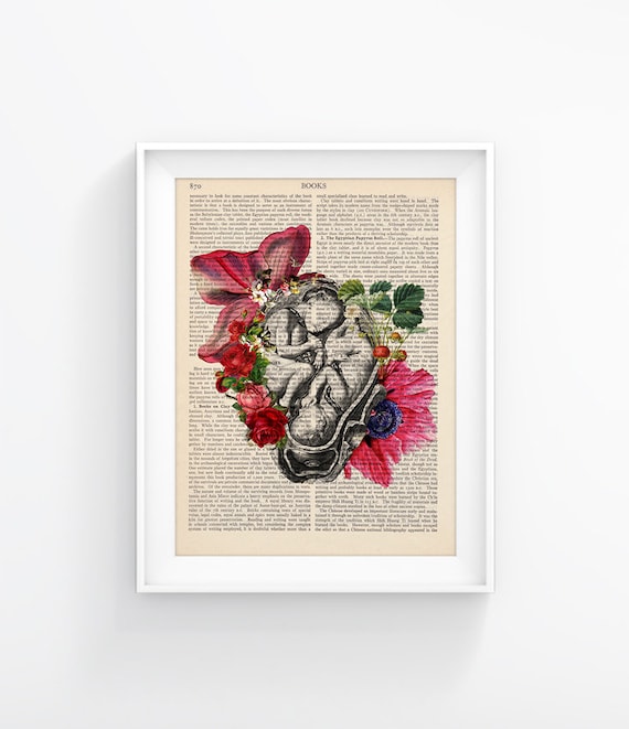 Twins Fetus Print, Womb Mates, Medical Art, Anatomy Illustration