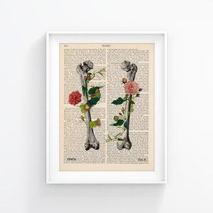 Femur Bone Print, Orthopedic Gift, Anatomy Illustration, Orthopedics, Doctor Office Decor, Chiropractor Art