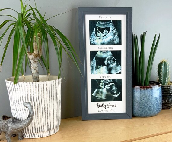 Baby Multi Scan Frame, Baby Gift, Nursery Decor, Ultrasound Frame