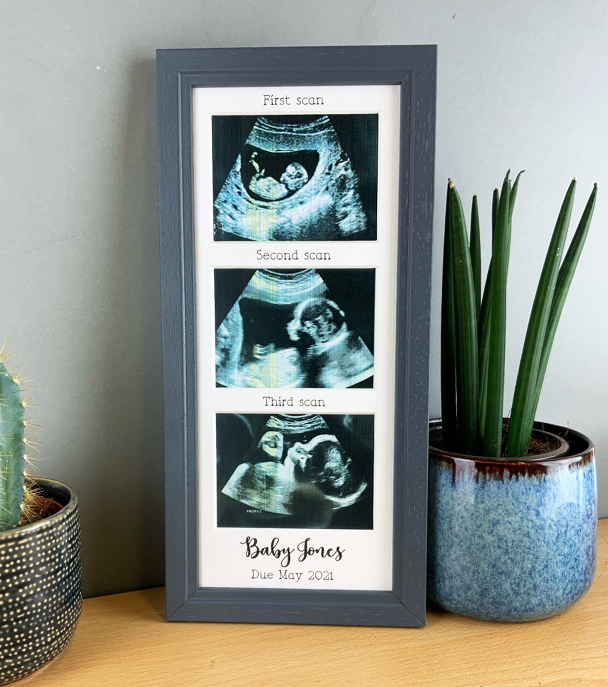 trlry Triple Ultrasound Picture Frames, Sonogram Picture Frame 3  Photos,Pregnancy Announcements,Pregnancy Gifts for First Time Moms,First  Time Mom
