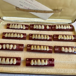 May include: A close-up of a case containing a set of dentures. The dentures are arranged in rows and labeled with numbers and letters. The case is made of a light brown material and has a velvet lining.
