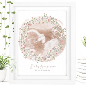 FRAMED Watercolour Baby Scan Print Art, Baby Scan Frame, Baby Shower Gift, Ultrasound Scan Gift, Baby Scan Photo, Mothers Day Gift From Bump
