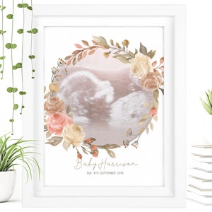FRAMED Watercolour Baby Scan Print Art, Baby Scan Frame, Baby Shower Gift, Ultrasound Scan Gift, Baby Scan Photo, Mothers Day Gift From Bump