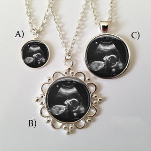 Puede incluir: Tres collares de plata con colgantes de diferentes tamaños que muestran imágenes de ultrasonido en blanco y negro de un bebé. Los colgantes están etiquetados con A, B y C.