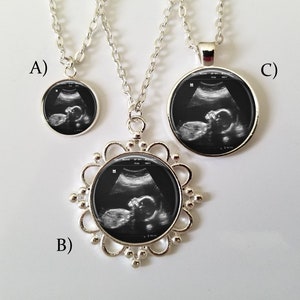 Ultrasound Charm Necklace Custom Sonogram Pendant Ultrasound necklace Big sister gift Sterling Silver Plated Choose from 3 sizes image 1