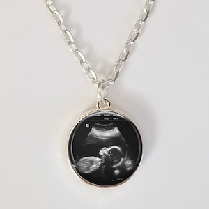 Ultrasound Charm Necklace Custom Sonogram Pendant Ultrasound necklace Big sister gift Sterling Silver Plated Choose from 3 sizes a) .75"