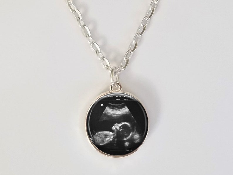 Ultrasound Charm Necklace Custom Sonogram Pendant Ultrasound necklace Big sister gift Sterling Silver Plated Choose from 3 sizes a) .75"