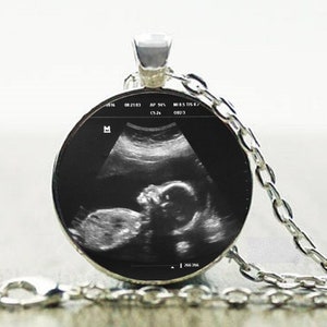 Ultrasound Charm Necklace Custom Sonogram Pendant Ultrasound necklace Big sister gift Sterling Silver Plated Choose from 3 sizes c) 1"