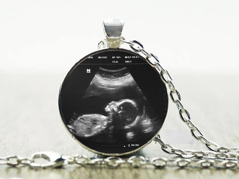 Ultrasound Charm Necklace Custom Sonogram Pendant Ultrasound necklace Big sister gift Sterling Silver Plated Choose from 3 sizes c) 1"