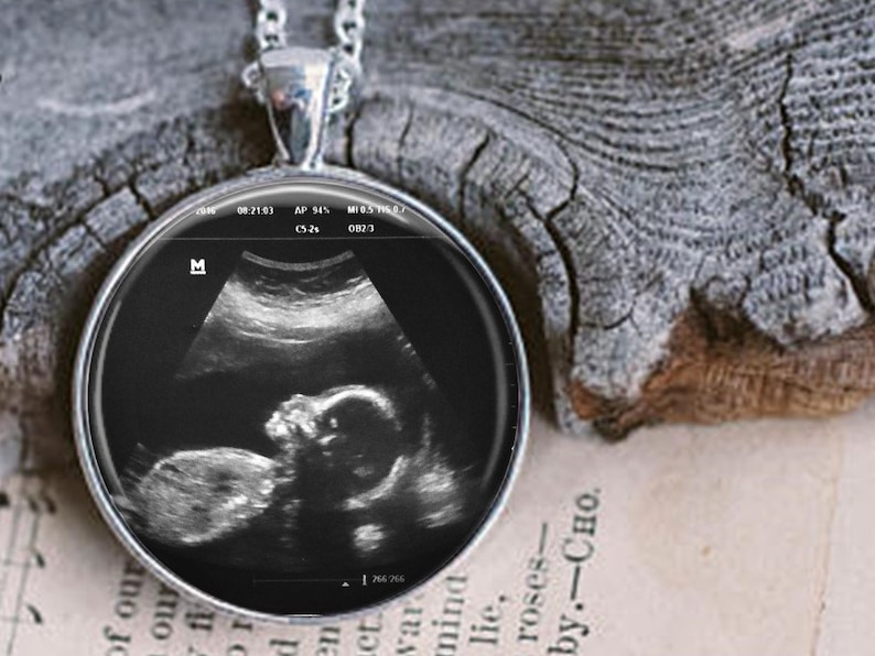 Ultrasound Charm Necklace Custom Sonogram Pendant Ultrasound necklace Big sister gift Sterling Silver Plated Choose from 3 sizes image 6