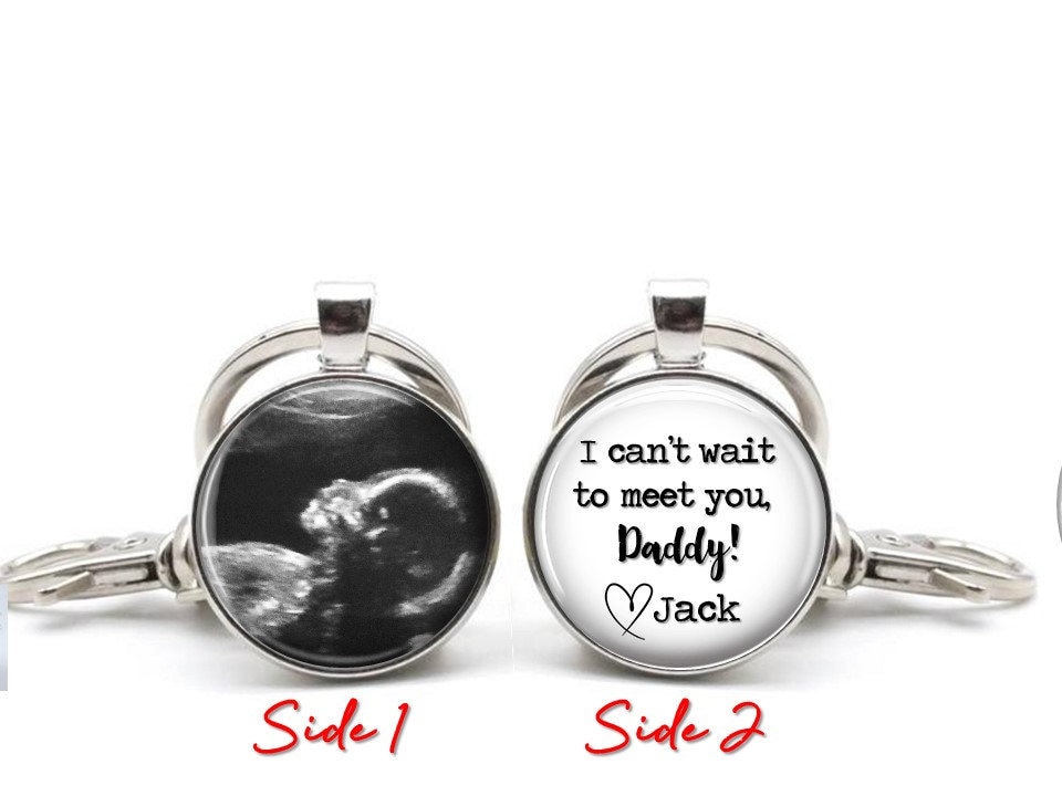 Ultrasound Keychain  - Custom personalized name words Ultrasound Sono…
