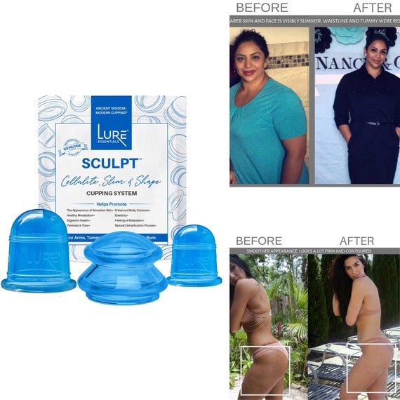 Anti Cellulite Cupping Set FREE Shipping 