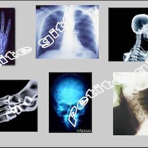 Miniature  Doctors Physician Medical X-RAYS -  Dollhouse     1/12     1/24     1/48     playscale miniature