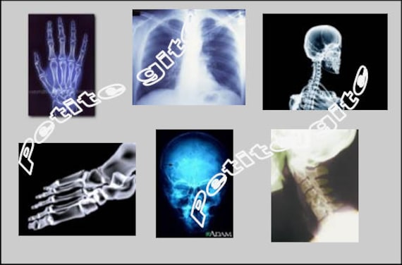 NOT REAL 1:12 dolls house miniature modern dental x-ray items 2 to choose from.