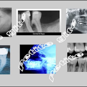 6 Miniature xrays  Orthodontist, Dentist, Medical Dental X-rays   -  Dollhouse      1/12     1/24     1/48    scale miniature