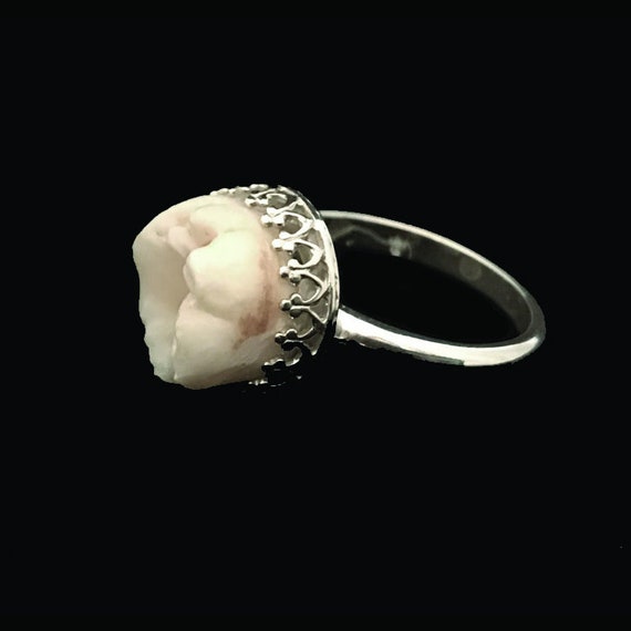Integración Es decir Microbio Molar de diente humano real en ajuste de anillo de 10 mm - Etsy España Integración Es decir Microbio Molar de diente humano real en ajuste de anillo de 10 mm - Etsy España
