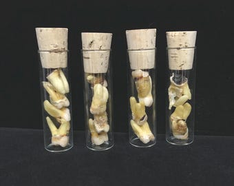 4 real human teeth in vial//curio cabinet//real teeth vial//curio cabinet//curiosity//taxidermy//real human teeth//oddities//medical decor