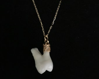 Real human molar tooth necklace//14K gold plated 20" fine chain//dainty tooth necklace//human tooth jewelry//teeth jewelry//real human tooth