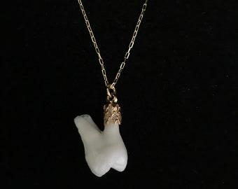 Real Human Molar Necklace - 14K Gold Filled Chain