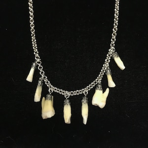 Real human tooth necklace//17&quot; silvertone thin link vintage chain 8 human teeth charms//human teeth jewelry//real tooth jewelry//human molar