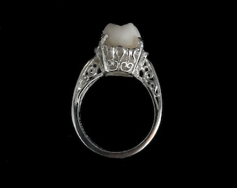 Sterling Silver Real Human Molar Ring, Filigree Engagement Ring Setting, Size 7