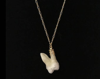 real human molar tooth necklace//12K gold filled 20" figaro chain//tooth necklace//human tooth jewelry//12k gold//teeth jewelry//human tooth