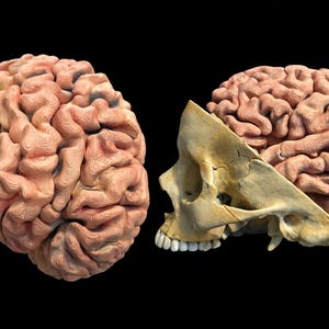 May include: A detailed anatomical illustration of a human brain and skull against a black background. The brain is a light pink color, with visible gyri and sulci. The skull is a beige color, with the nasal cavity and teeth visible.