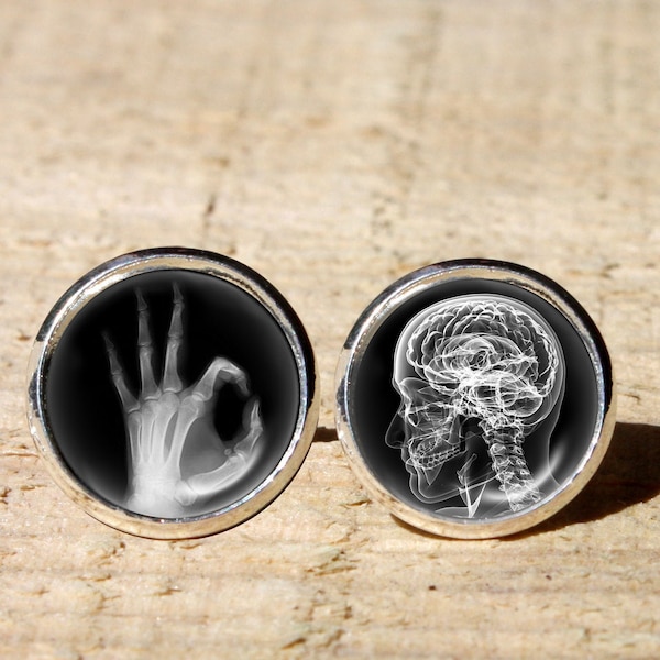 Handmade custom Hand and skull x-ray pair of earrings, Radiologist Earrings, gift for Doctor, XRay hypoallergenic, nikel free gift