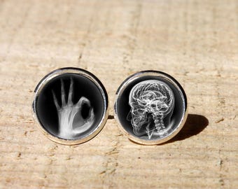X-Ray Earrings Skull Hand Radiologist Jewelry Hypoallergenic Stainless Steel Medical Student Doctor Graduation