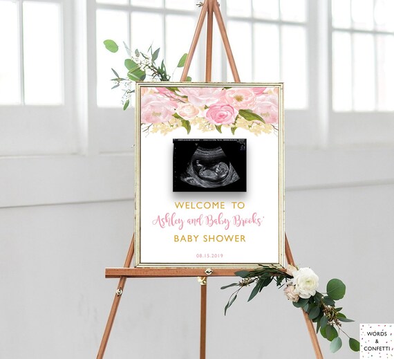 Sonogram Baby Shower Sign Ultrasound Baby Shower Decorations Etsy