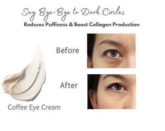 Coffee Infused Eye Cream| Eye Cream Reduces Wrinkles | Puffy Eyes & Dark Circles