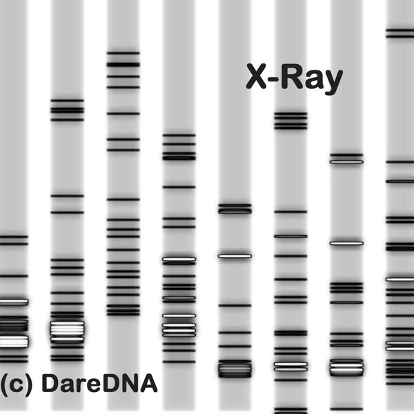 Cherish Your DNA: Custom Artwork für Genetic Enthusiasts - SVG Metall Leinwand Druck Geschenk, Genetik Medizin Schwarz Weiß - Genetiker X Ray DNS