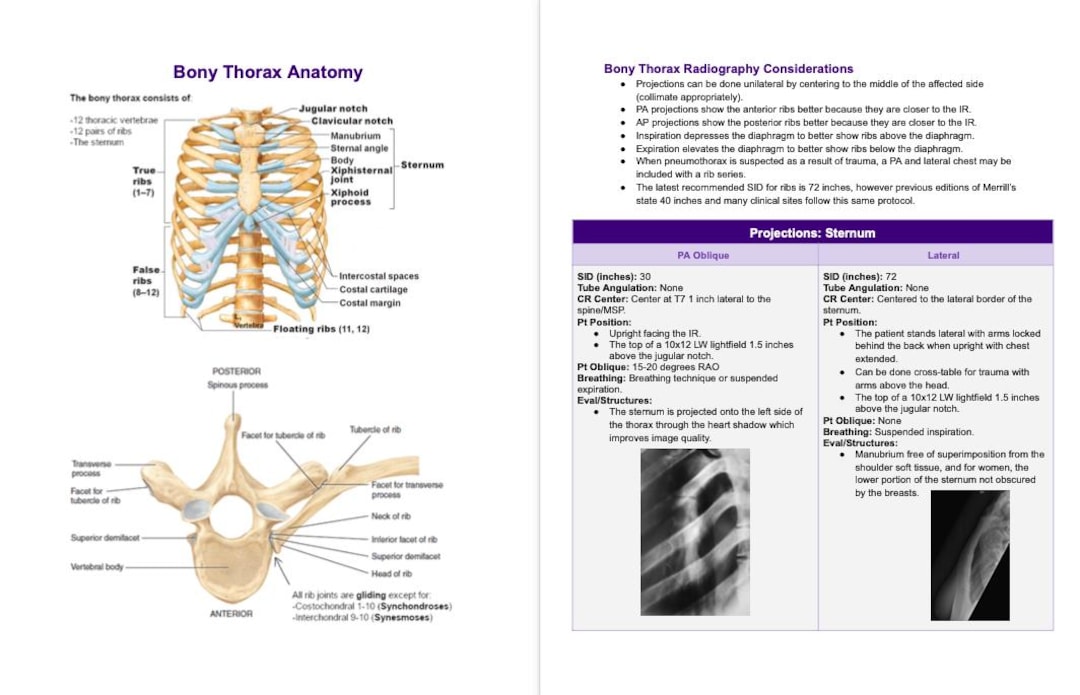 First Year Radiography Notes Rad Notes - Bony Thorax - Radiography Study Guide *digital Copy* - Etsy