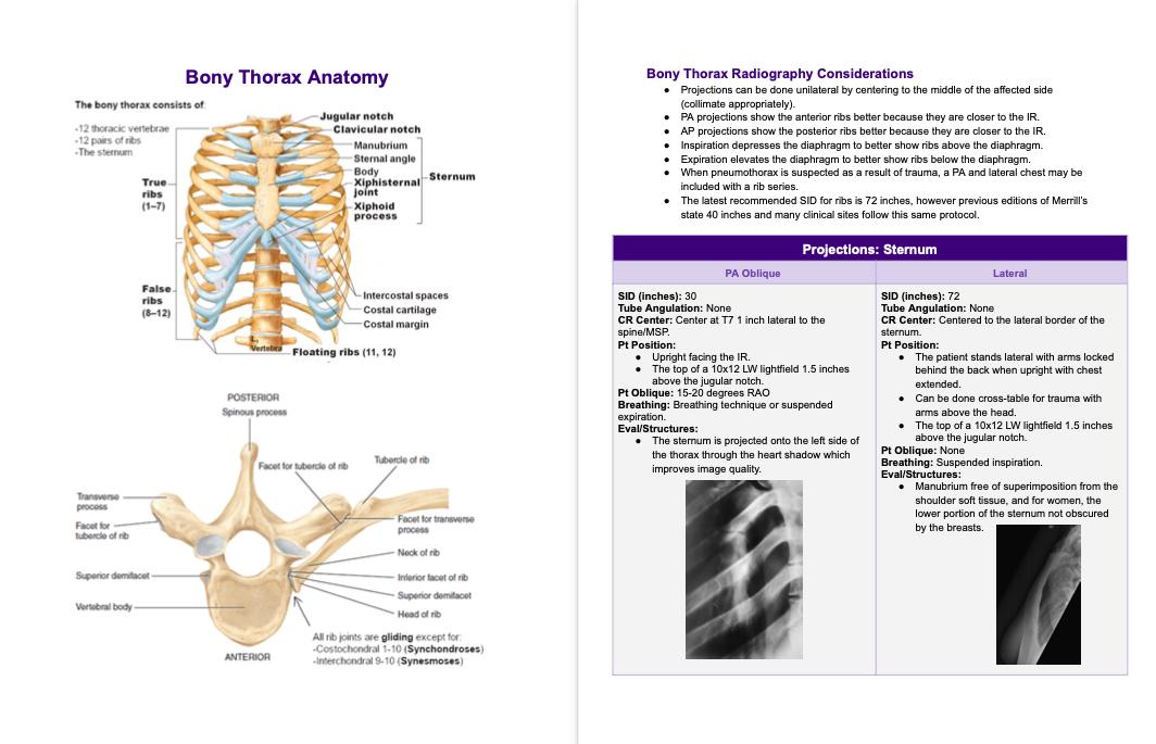 Thorax Rads Rad Notes - Bony Thorax - Radiography Study Guide *digital Copy* - Etsy