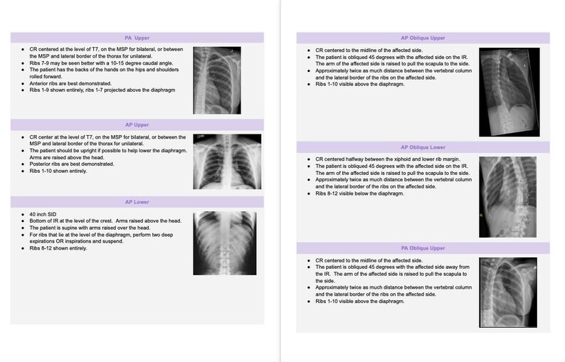 Thorax Rads Rad Notes - Bony Thorax - Radiography Study Guide *digital Copy* - Etsy