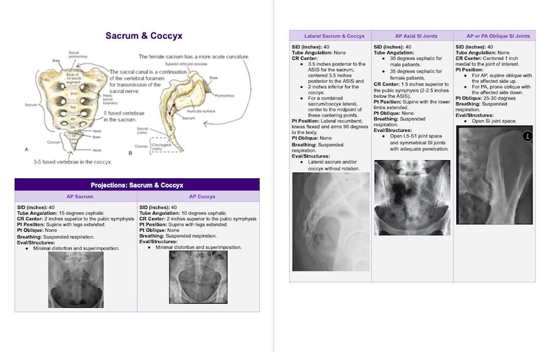 First Year Radiography Notes Rad Notes - Spine - Radiography Study Guide *digital Copy* - Etsy