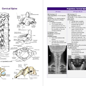 Rad Notes - Spine - Radiography Study Guide *Digital Copy*