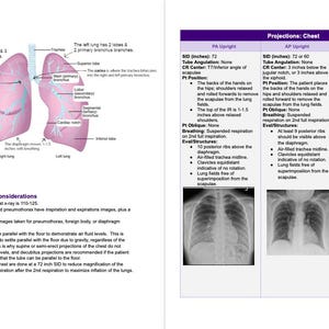 Rad Notes - Chest & Abdomen - Radiography Study Guide *Digital Copy*