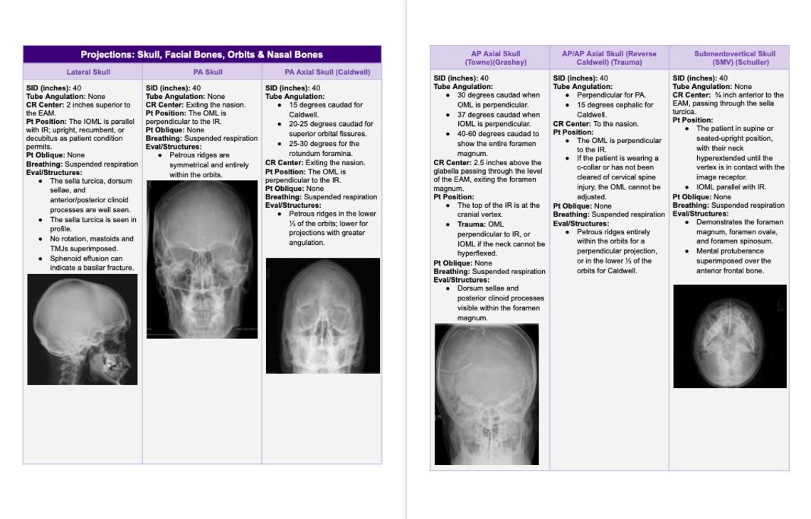 First Year Radiography Notes Rad Notes - Head Procedures - Radiography Study Guide *digital Copy* - Etsy