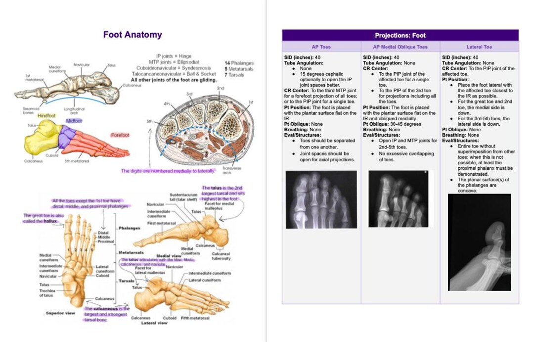Rad Notes - Lower Extremity - Radiography Study Guide *digital Copy ...