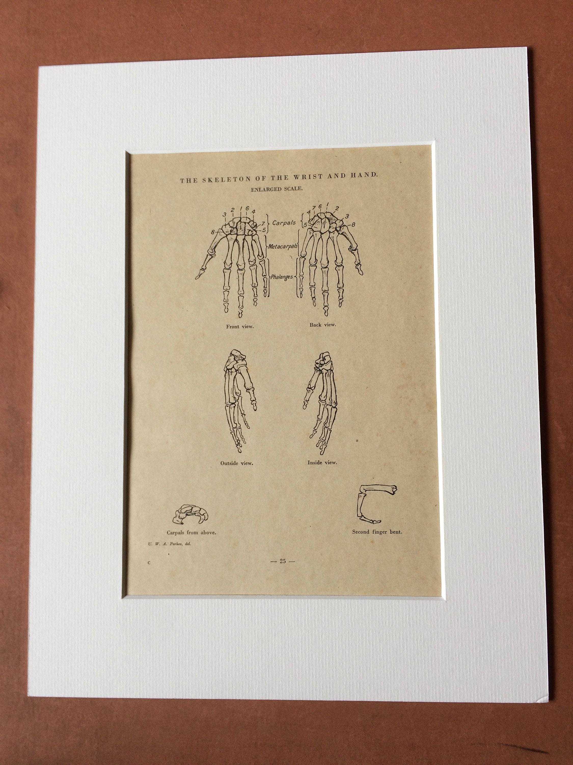 1949 Original Vintage Anatomical Print - Wrist and Hand Bones - Anatomy ...