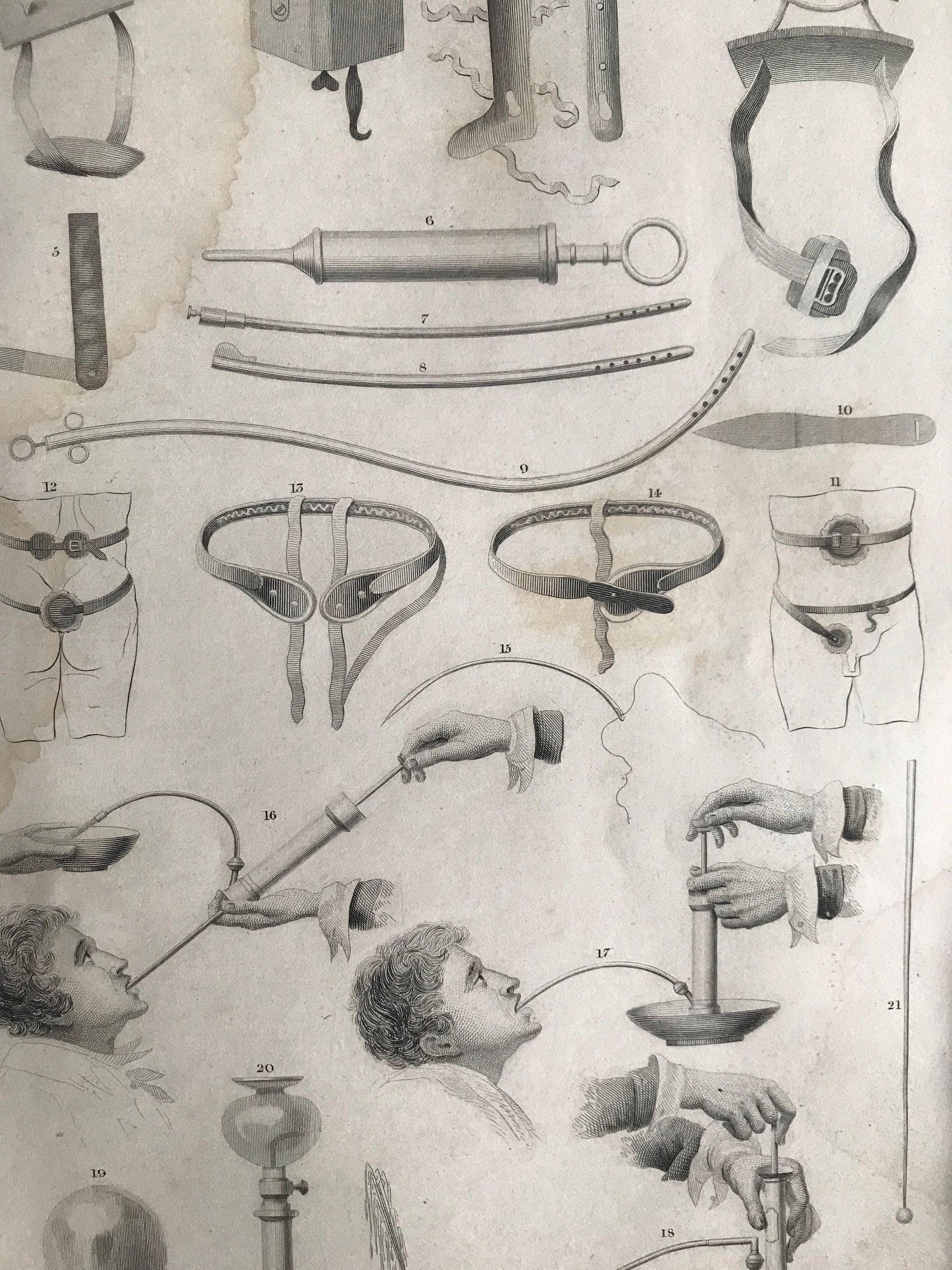 1858 Surgical Instruments Original Antique Engraving Surgery Etsy UK