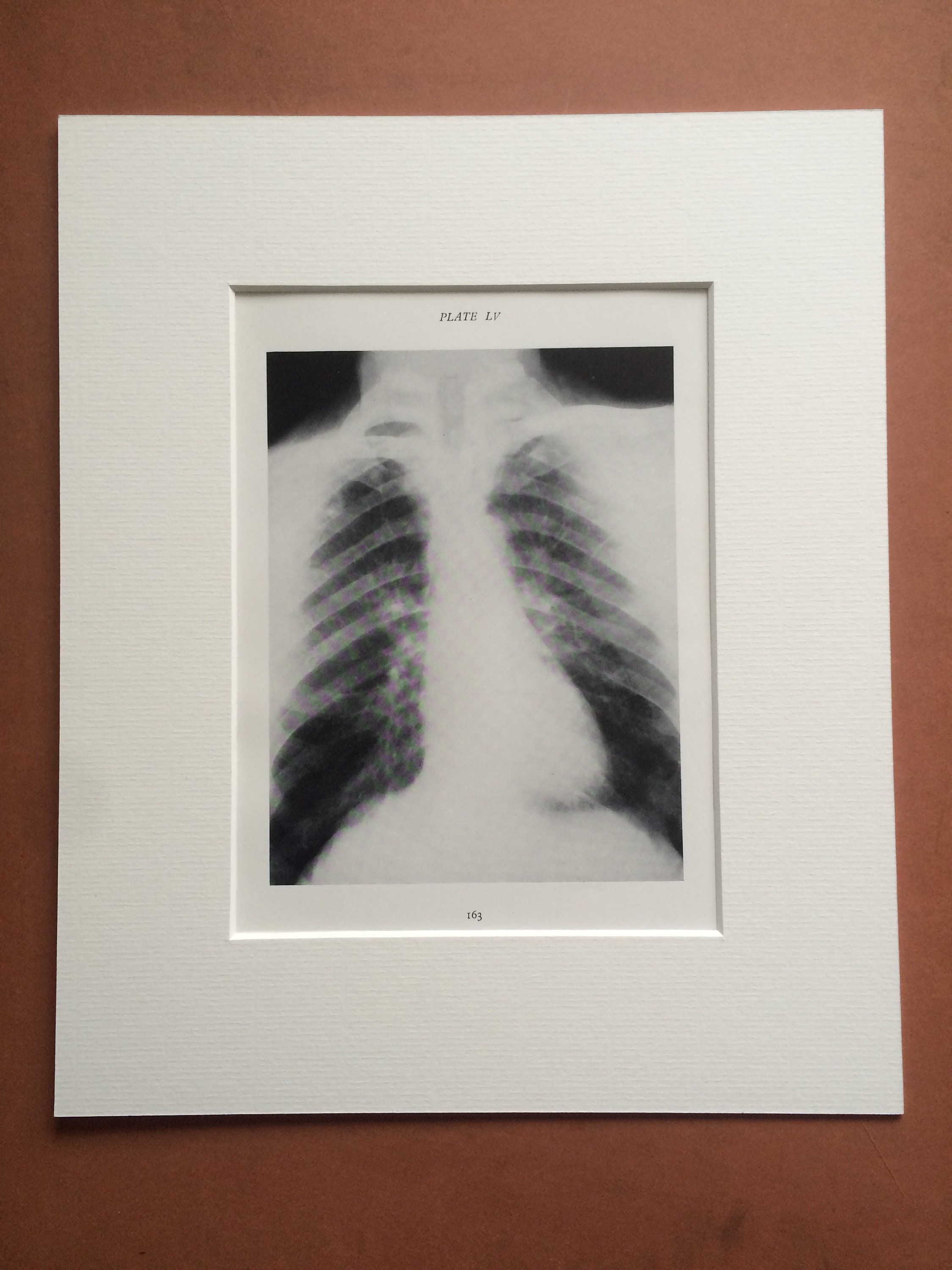 1941-chest-lung-x-ray-original-vintage-print-mounted-and-matted