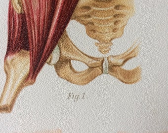 1902 Original Antique Anatomical Print - Fracture - Dislocation - Medical Decor - Anatomy - Science - Anatomy - Anatomical Decor