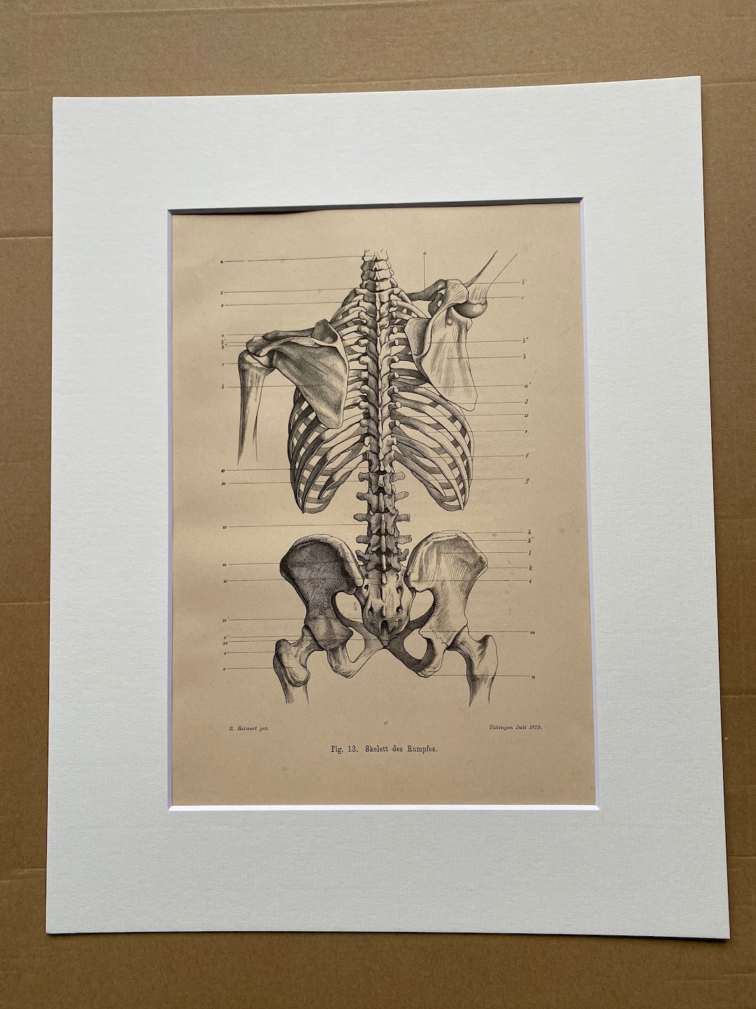 1890 Original Antique Anatomical Print - Skeleton - Bones - Anatomy ...