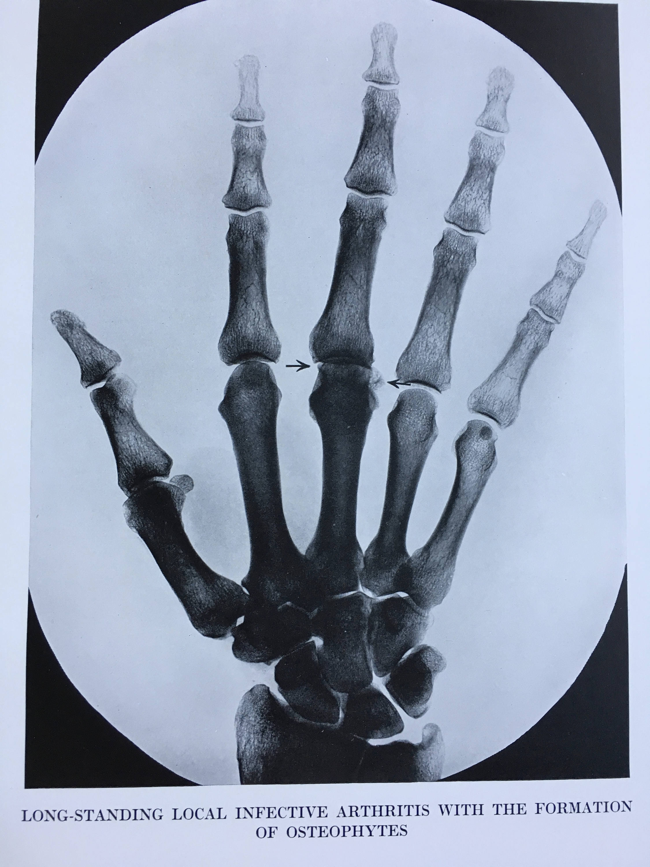 1935 Original Vintage Print Available Framed Radiology Rheumatic