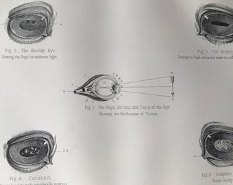 1880 Equine Anatomy - The Eye of the Horse, in Health and in Disease Original Antique Print - Mounted and Matted - Available Framed